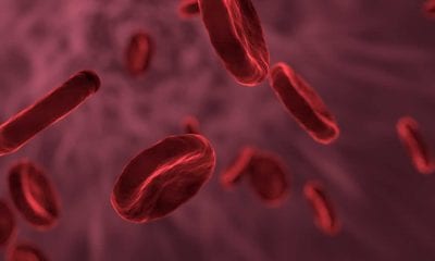 Три продукта, заставляющие артерии «сужаться» и повышают риск тромбов