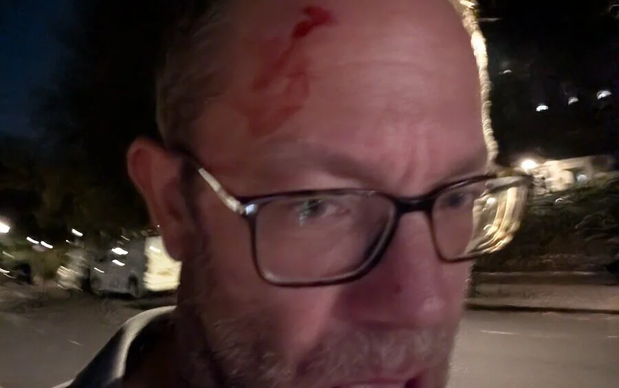 Jewish man says he was beaten after confronting anti-Israel vandals in London