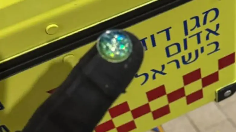התינוק הכחיל - החובש שלף את קישוט הסוכה