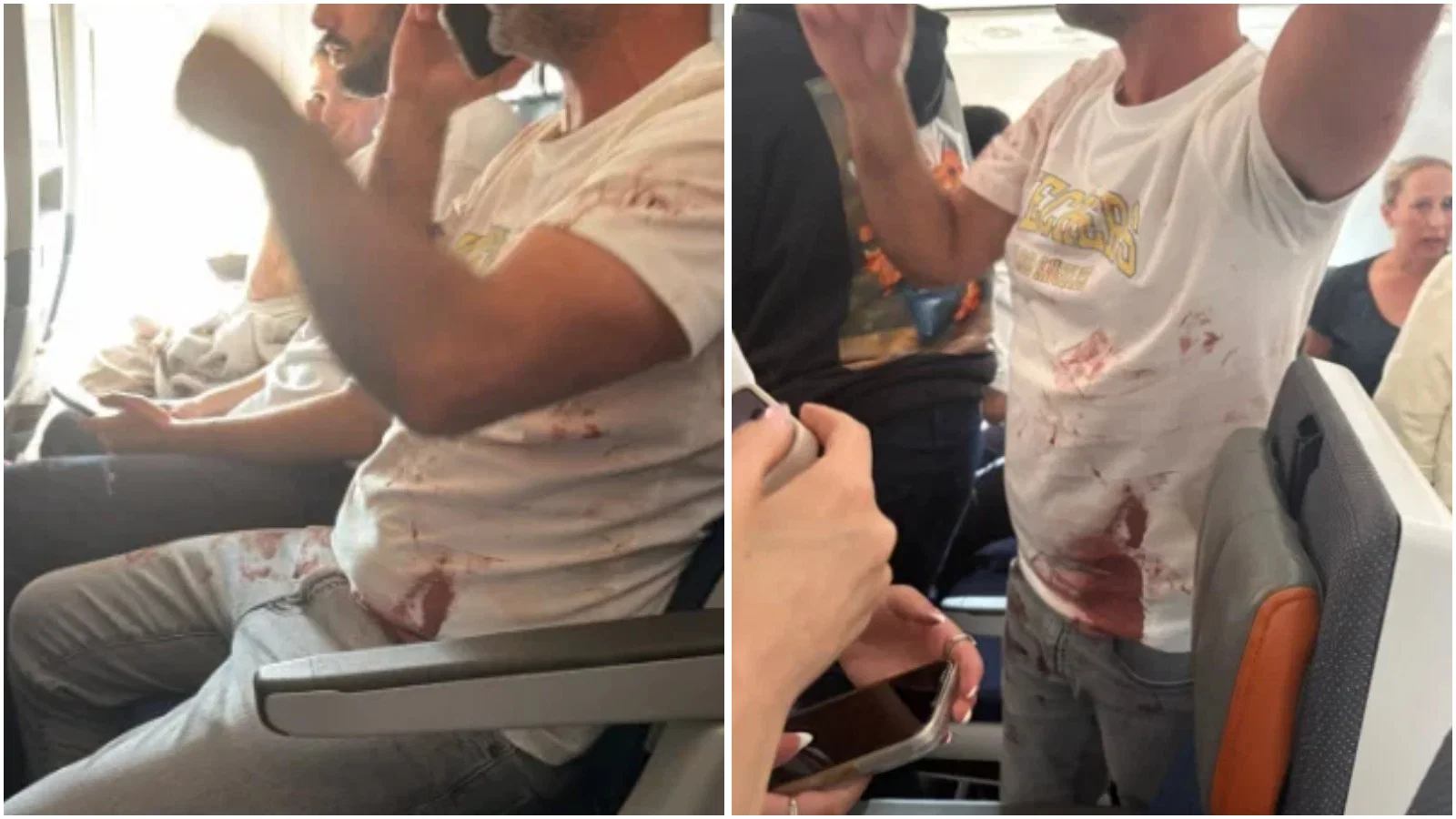 הסימנים כרגע מראים: הטייס ניסה להשתלט על המטוס ולרסק אותו יחד עם כל הנוסעים | תיעוד נוסע מלא בדם - לאחר מאבק