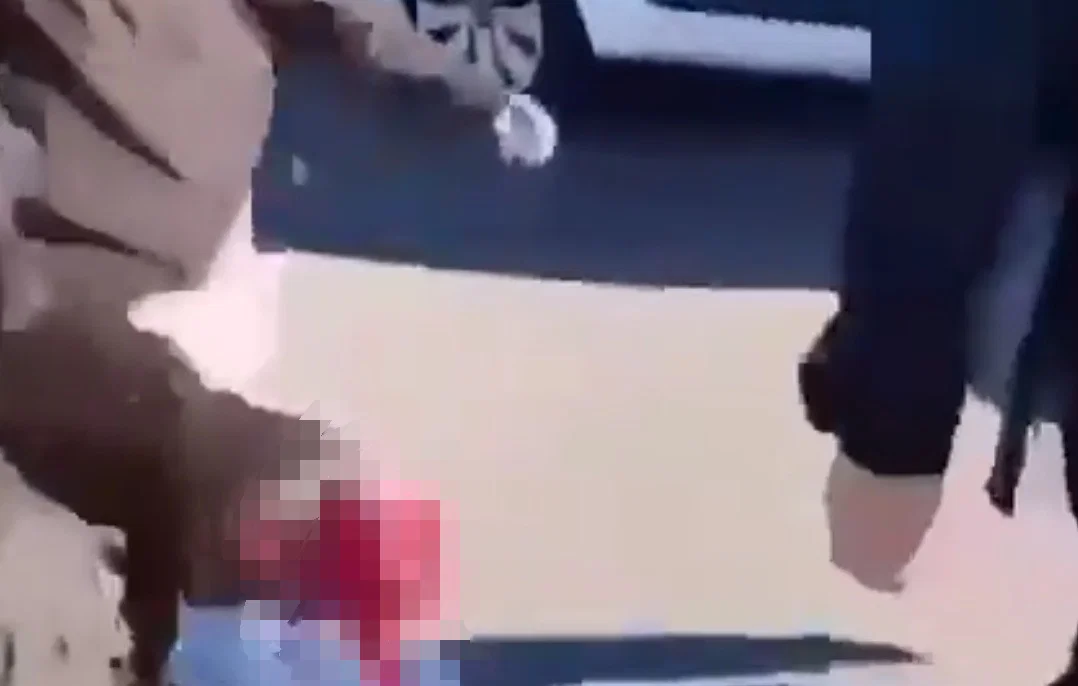 זוועה בצרפת: נער ניסה להשליך בחזרה רימון על שוטרים - היד שלו נתלשה בפיצוץ