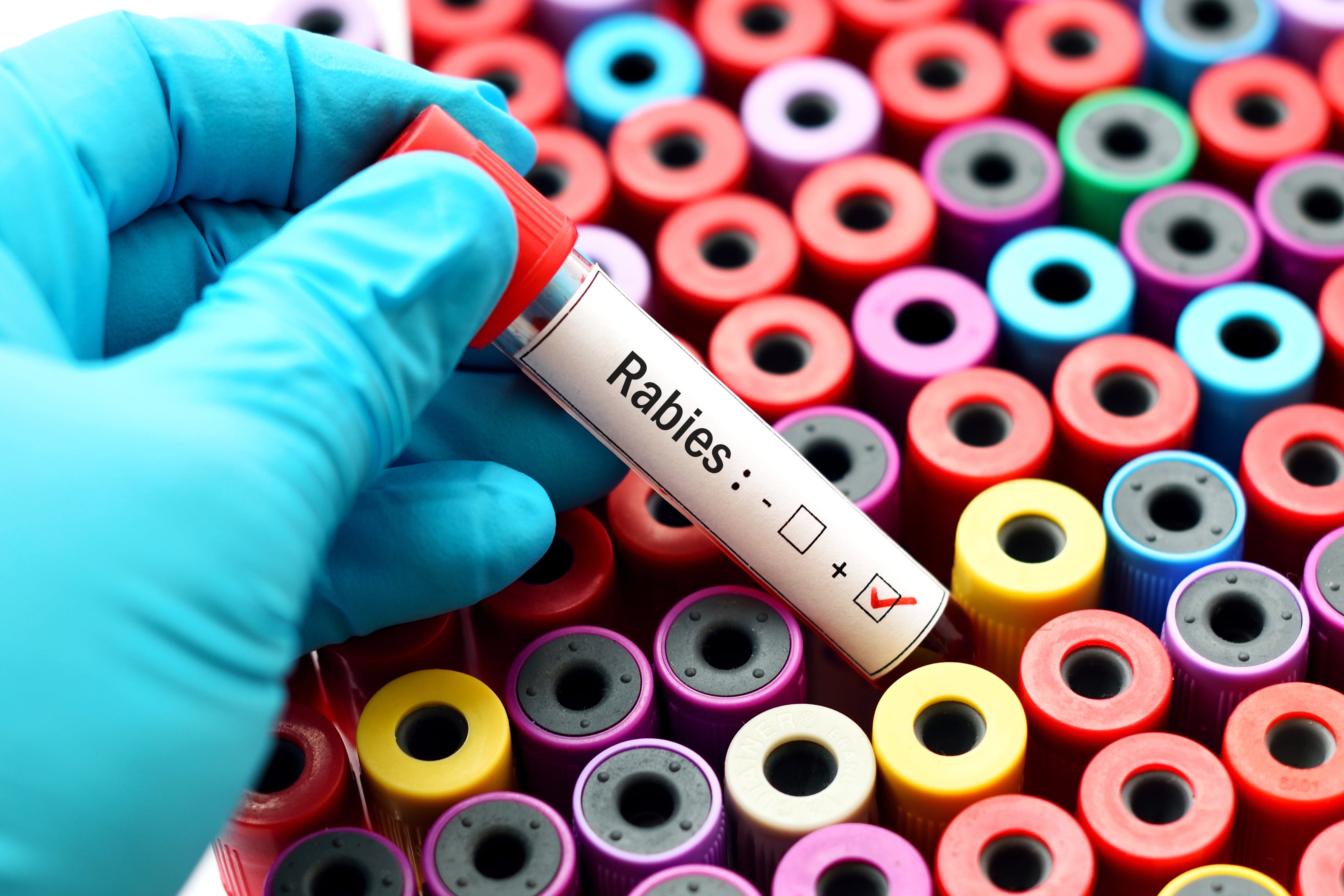 Rabies Alert Issued After 4 Israelis Come into Contact with Infected Donkey in Golan Heights