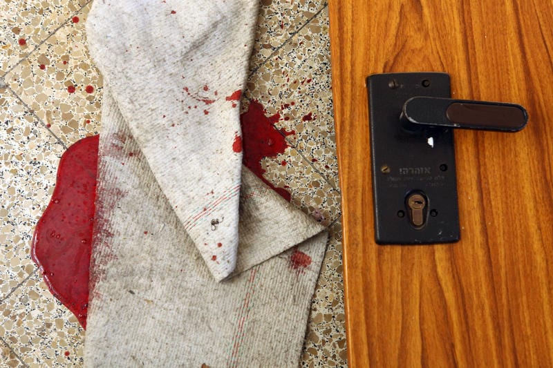 Five-Year-Old Girl Suffers Severe Hand Injury in Bnei Brak Home Accident