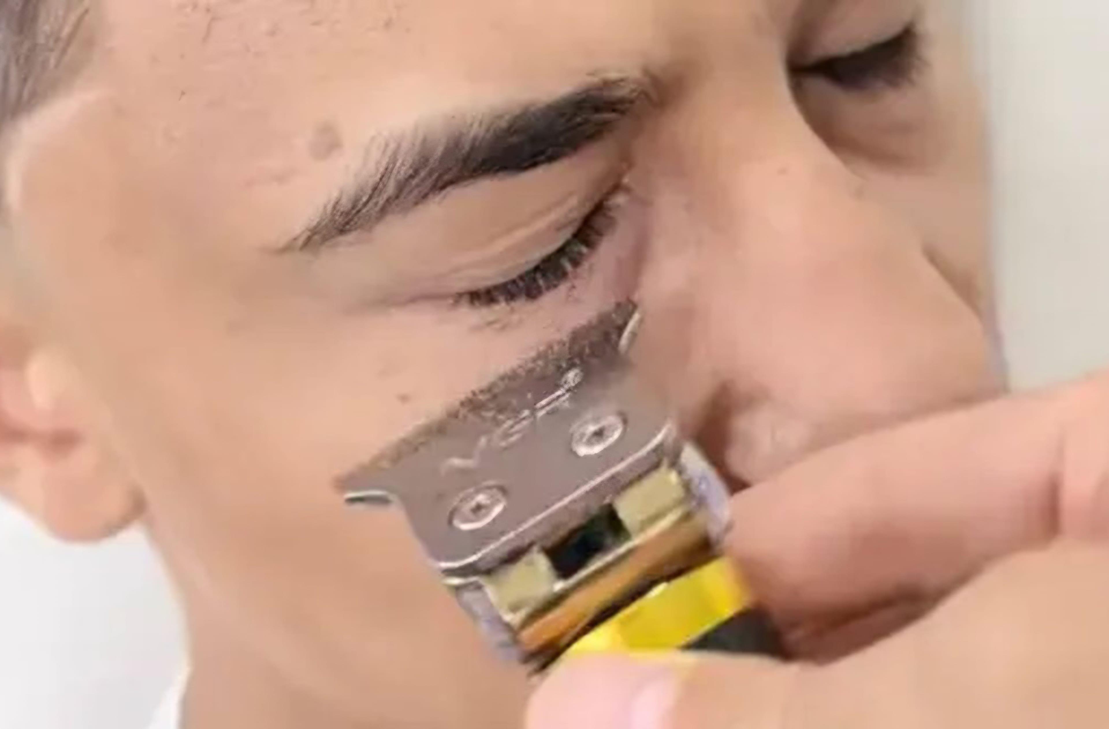Medical Experts Warn Against Viral Eyelash Trimming Trend Among Men
