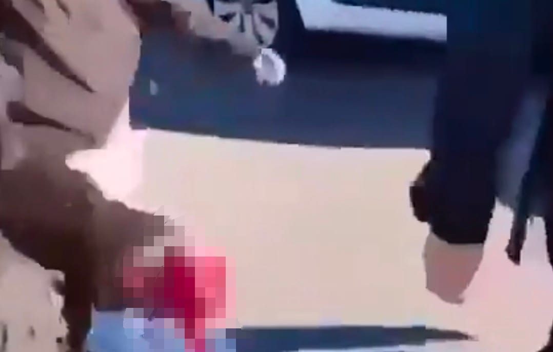 France: Teen's Hand Torn off after Grenade He Threw at Police Explodes Mid-air