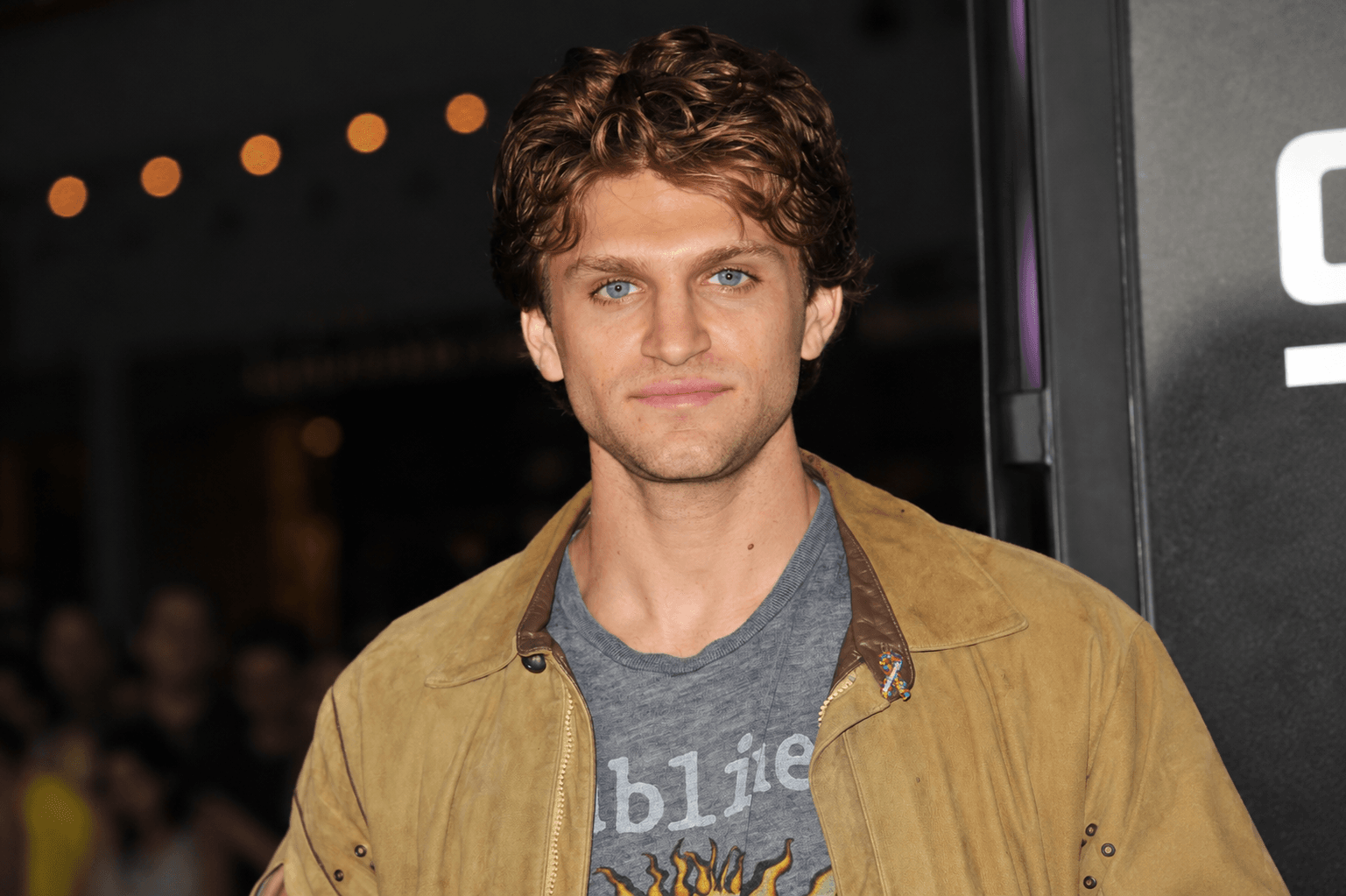 Actor From Hit Series Robbed at Gunpoint in West Hollywood, Shares Bloodied Photos