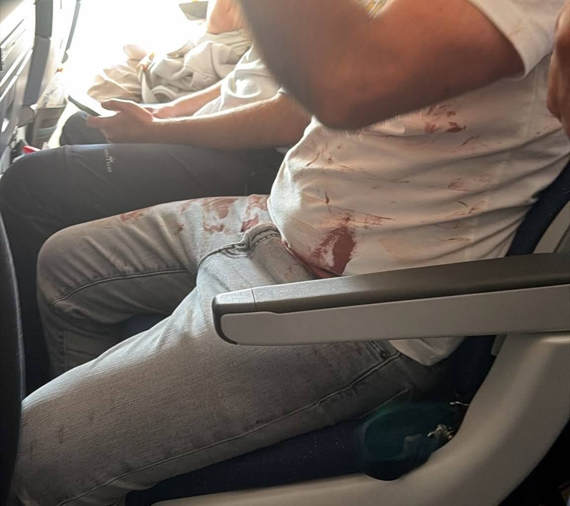בכיר ישראלי: "הטייס תכנן לבצע פיגוע כמו ב-11/9"