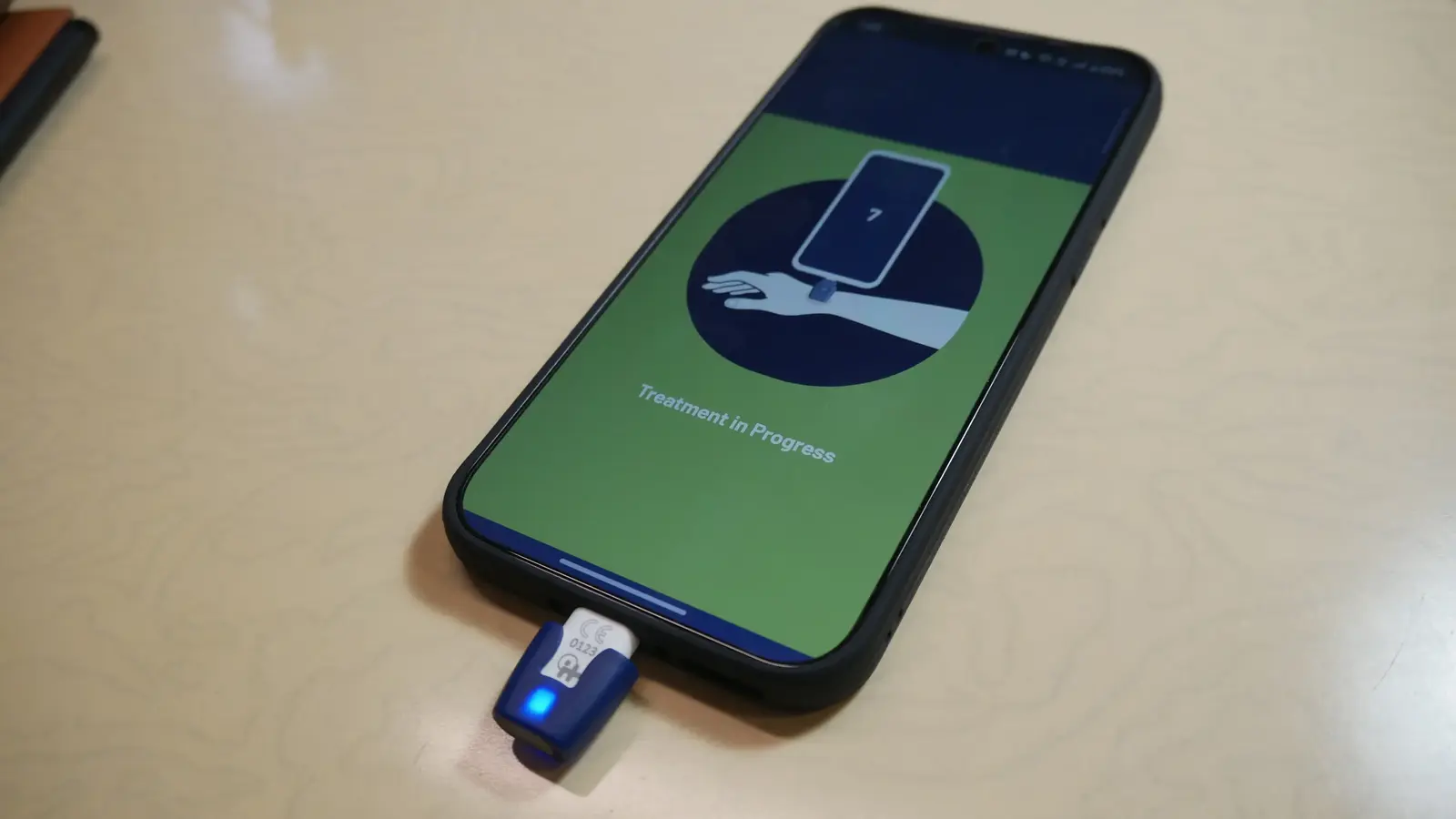 בדקנו: פטנט USB שמקל על עקיצות יתושים