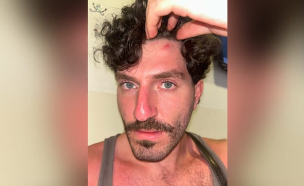 מתקפה הומופובית בבריכה של המלון בירושלים: "הוא אמר שאם אחזור עם הספידו - לא אצא חי"