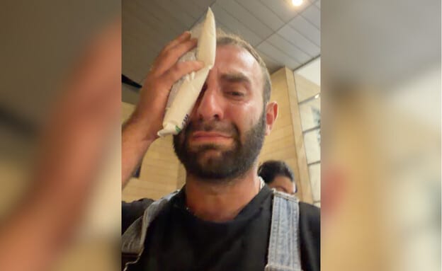 חשד לתקיפה הומופובית בתל אביב: "פוצצו אותי מכות"