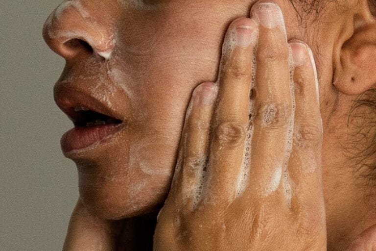 Adult Acne Is Real, But There Are Ways To Treat It. Here’s What To Know