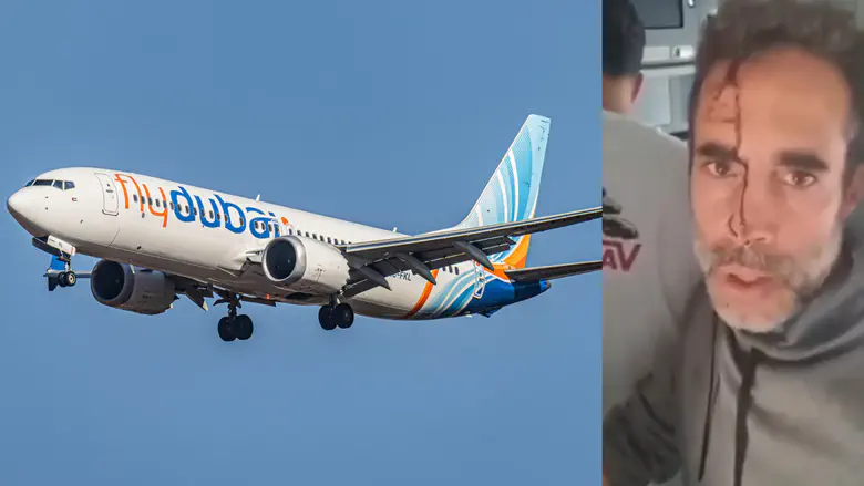 עם דם על הפנים: הנוסע תיעד את הרגעים שאחרי ההשתלטות על המחבל
