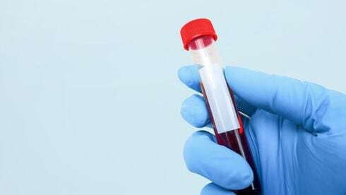 בדרך לאישור: פאנל ה-FDA תמך בבדיקת דם לגילוי יותר מ-50 סוגי סרטן