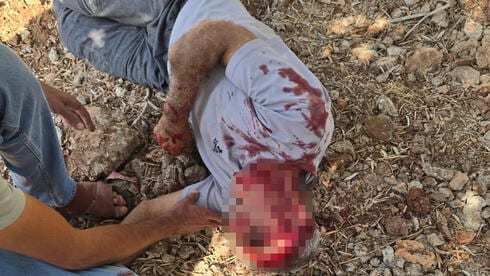 "מתנחלים תקפו עם אלות": פלסטיני בן 50 תועד מדמם במסיק הזיתים