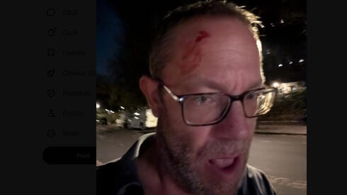 יהודי, שניסה למנוע ריסוס כתובת נאצה נגד ישראל, הותקף בלונדון: "בעטו לי בראש"
