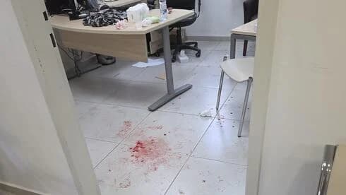 סיוט במרפאה: פסיכיאטר הותקף בראשו ונדקר במפתח שבדי, המטפלות הצילו אותו